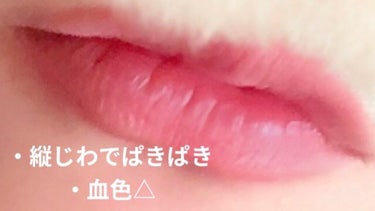 𝕪𝕦𝕞𝕖😶‍🌫️ on LIPS 「こんにちは！ゆめです！今回と言っても初投稿ですが…唇についてす..」（2枚目）