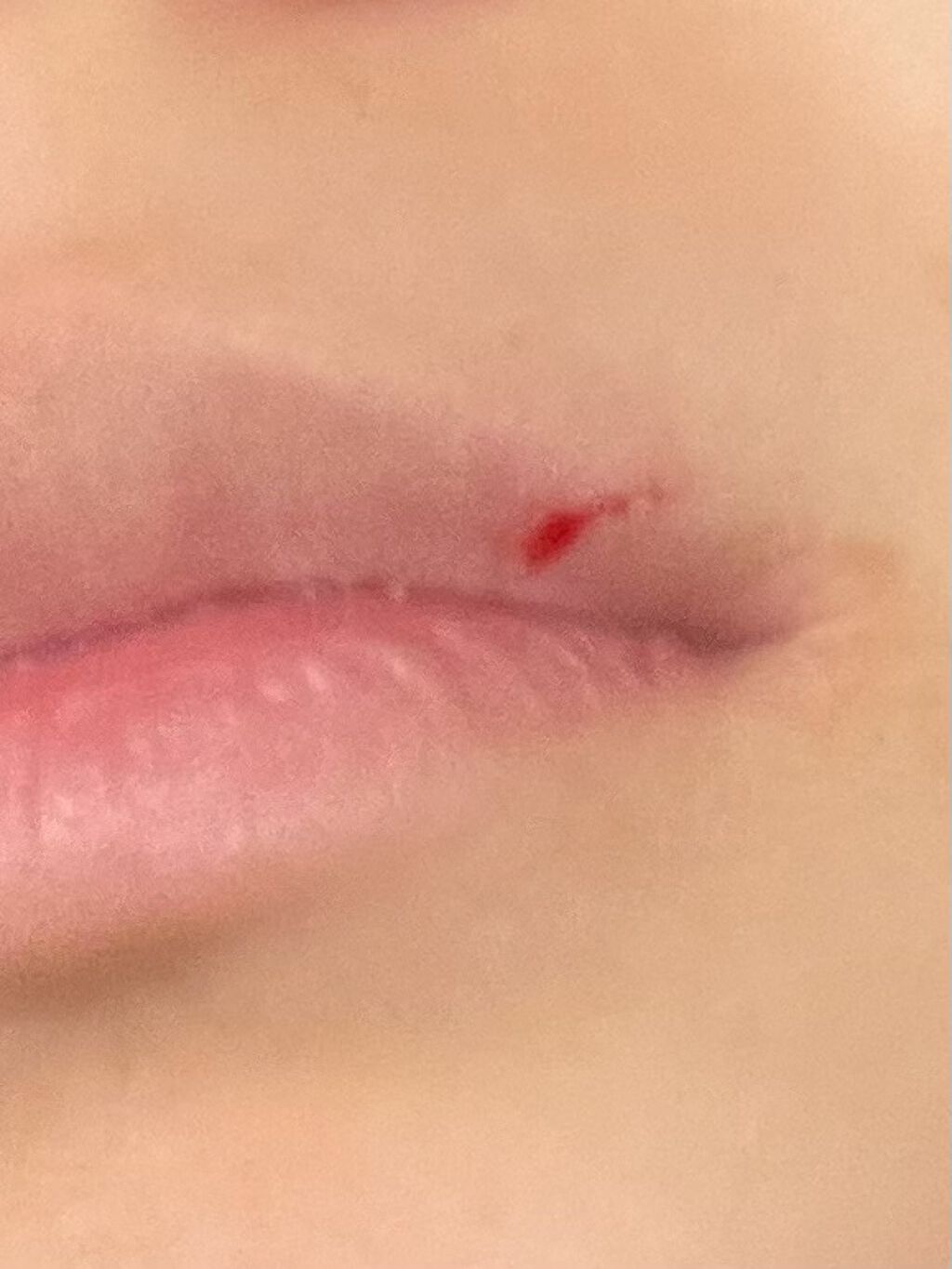 眉・顔剃り用カミソリL 3本入/DAISO/シェーバーを使ったクチコミ（2枚目）