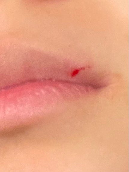 プリティー 敏感肌用フェイスL 3本入/貝印/シェーバーを使ったクチコミ(2枚目)