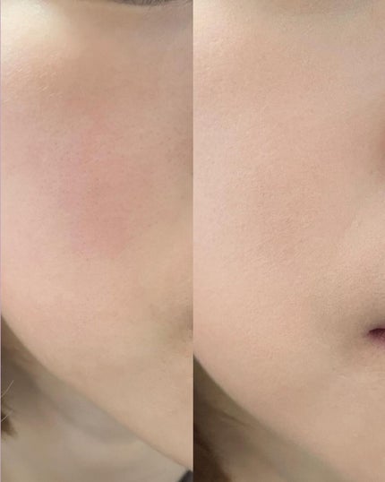 ハイパーカバーフィットクッション ピンク(桜エディション)/APRILSKIN/クッションファンデーションを使ったクチコミ(4枚目)