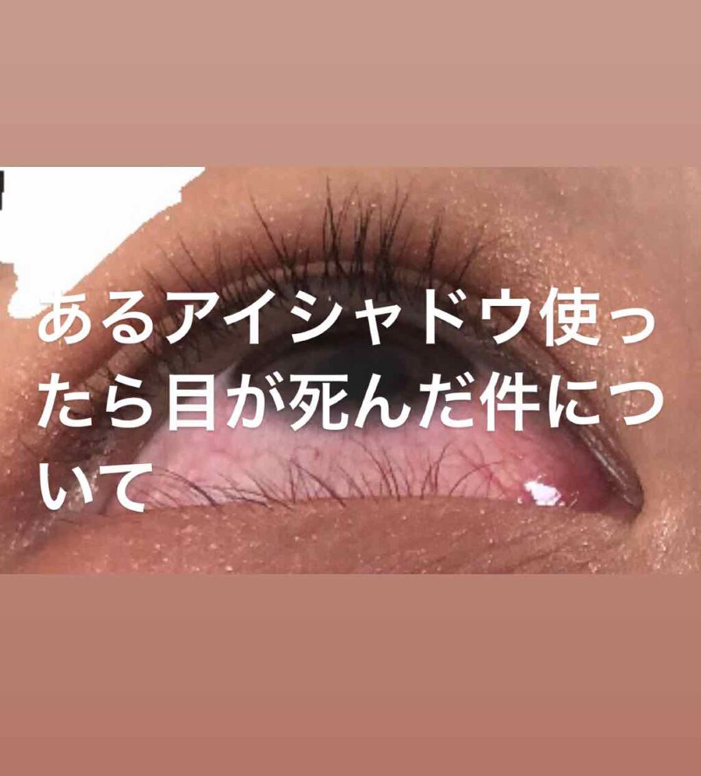 REINA on LIPS 「写真Normalで撮ってフィルターなしで痒すぎて擦ったため汚い..」(1枚目)