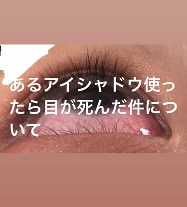 REINA on LIPS 「写真Normalで撮ってフィルターなしで痒すぎて擦ったため汚い..」（1枚目）