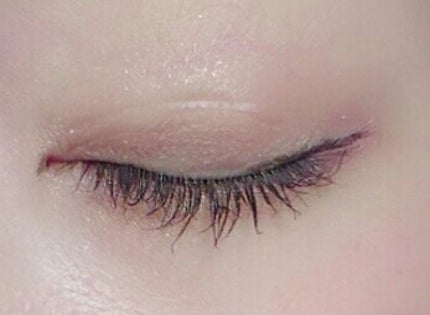 プラスチックテープ/白十字/その他を使ったクチコミ(3枚目)