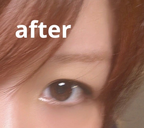 脱色クリーム 敏感肌用/エピラット/ムダ毛ケアを使ったクチコミ(3枚目)