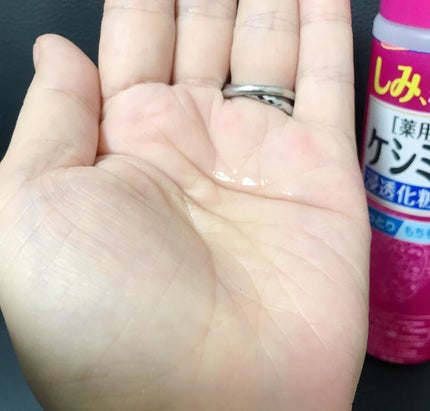 ケシミン浸透化粧水 しっとりタイプ/ケシミン/化粧水を使ったクチコミ(2枚目)