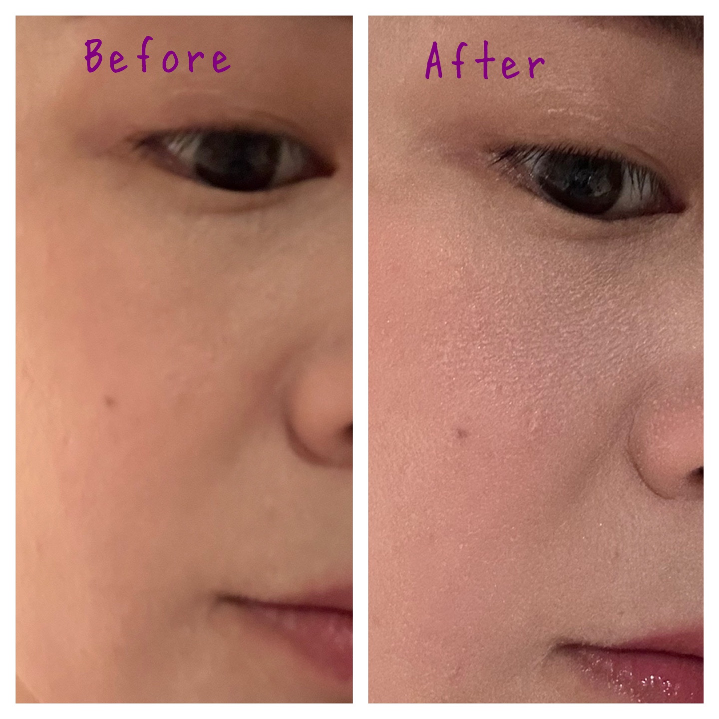 20th アニバーサリー フェイス コンパクト 103 透艶 - SUKITSUYA/SUQQU/パウダーハイライトを使ったクチコミ（3枚目）