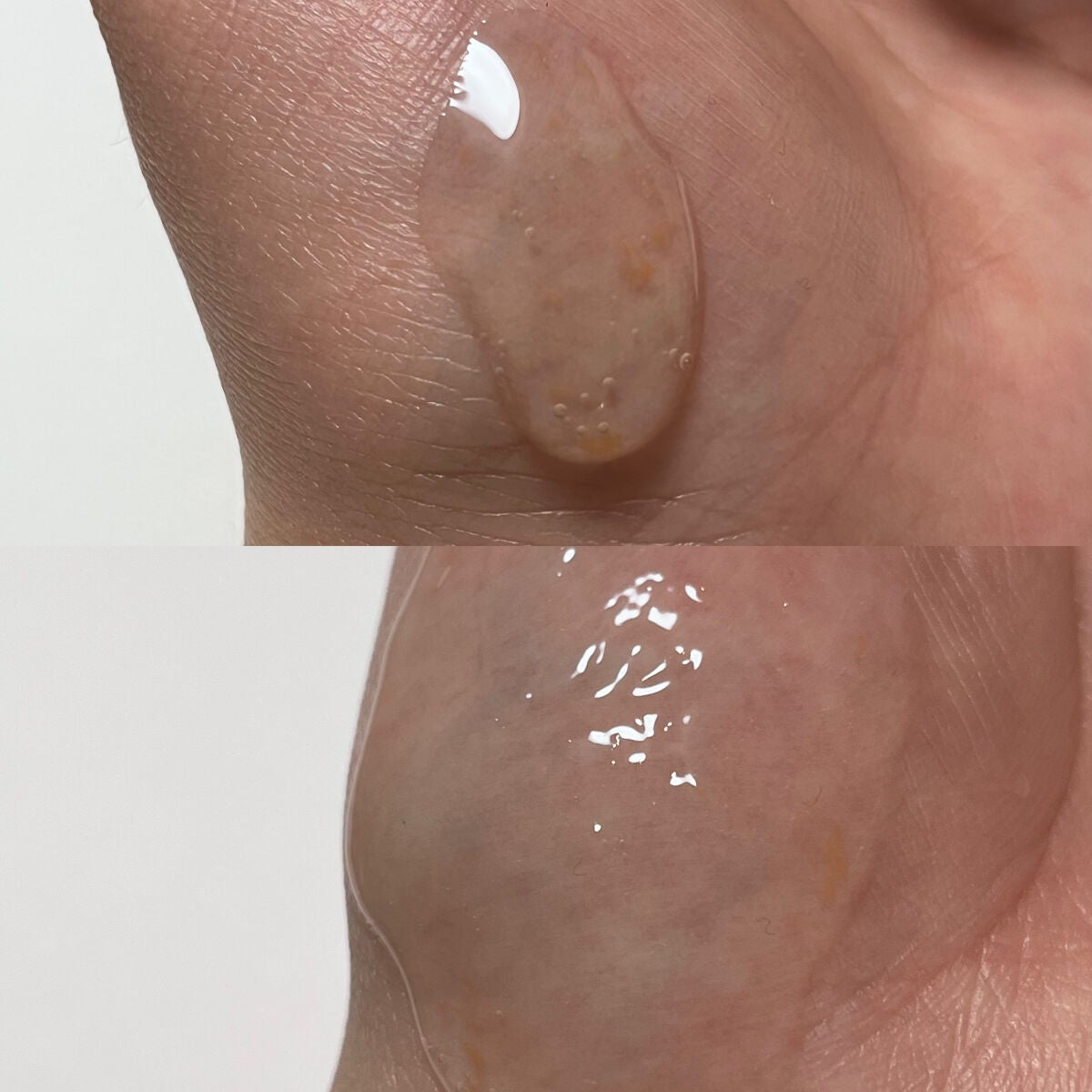 マデカバイタルカプセルセラム/センテリアン24/美容液を使ったクチコミ(3枚目)