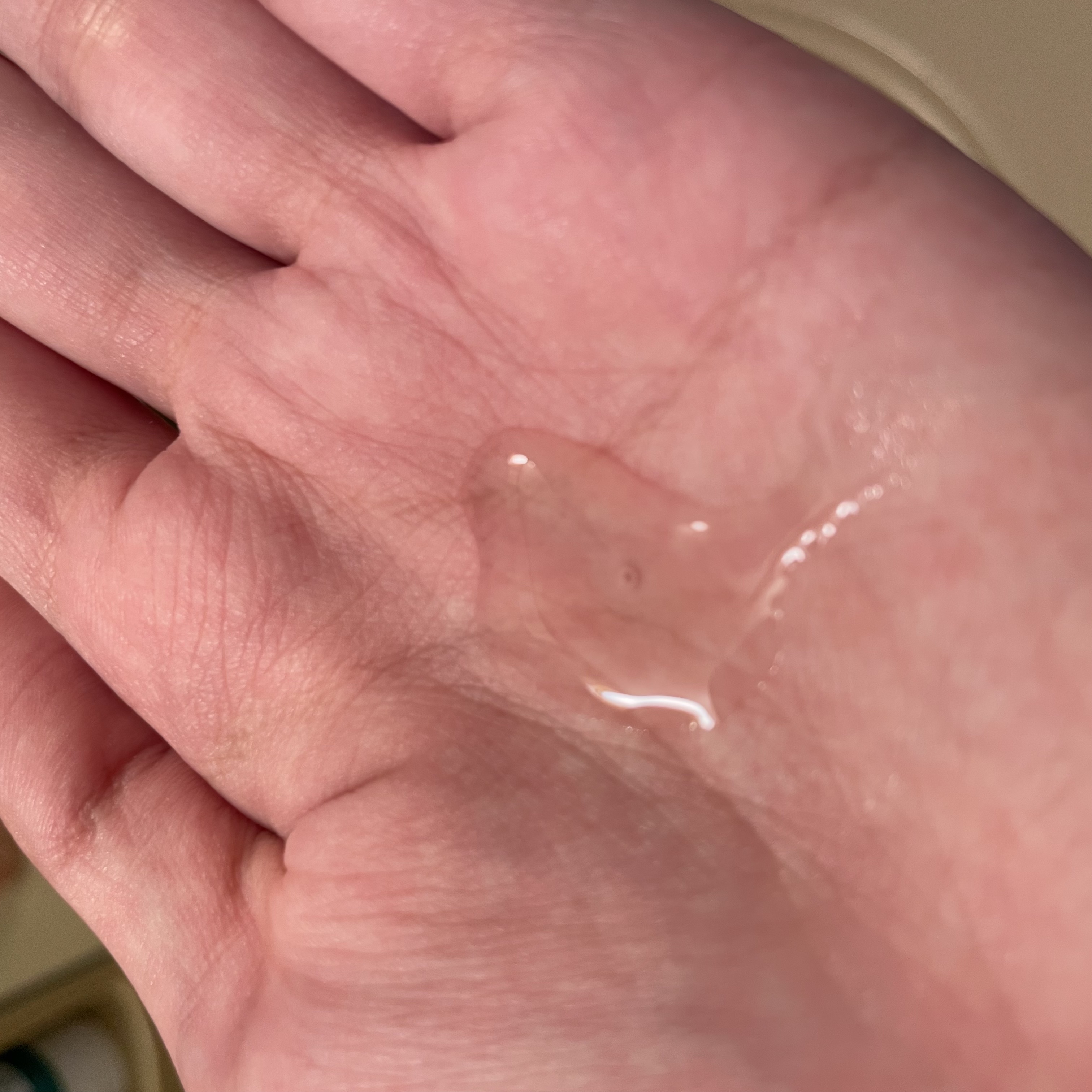 薬用 RJ地肌ケア エッセンス /アピセラピーコスメティクス/頭皮ローションを使ったクチコミ（2枚目）