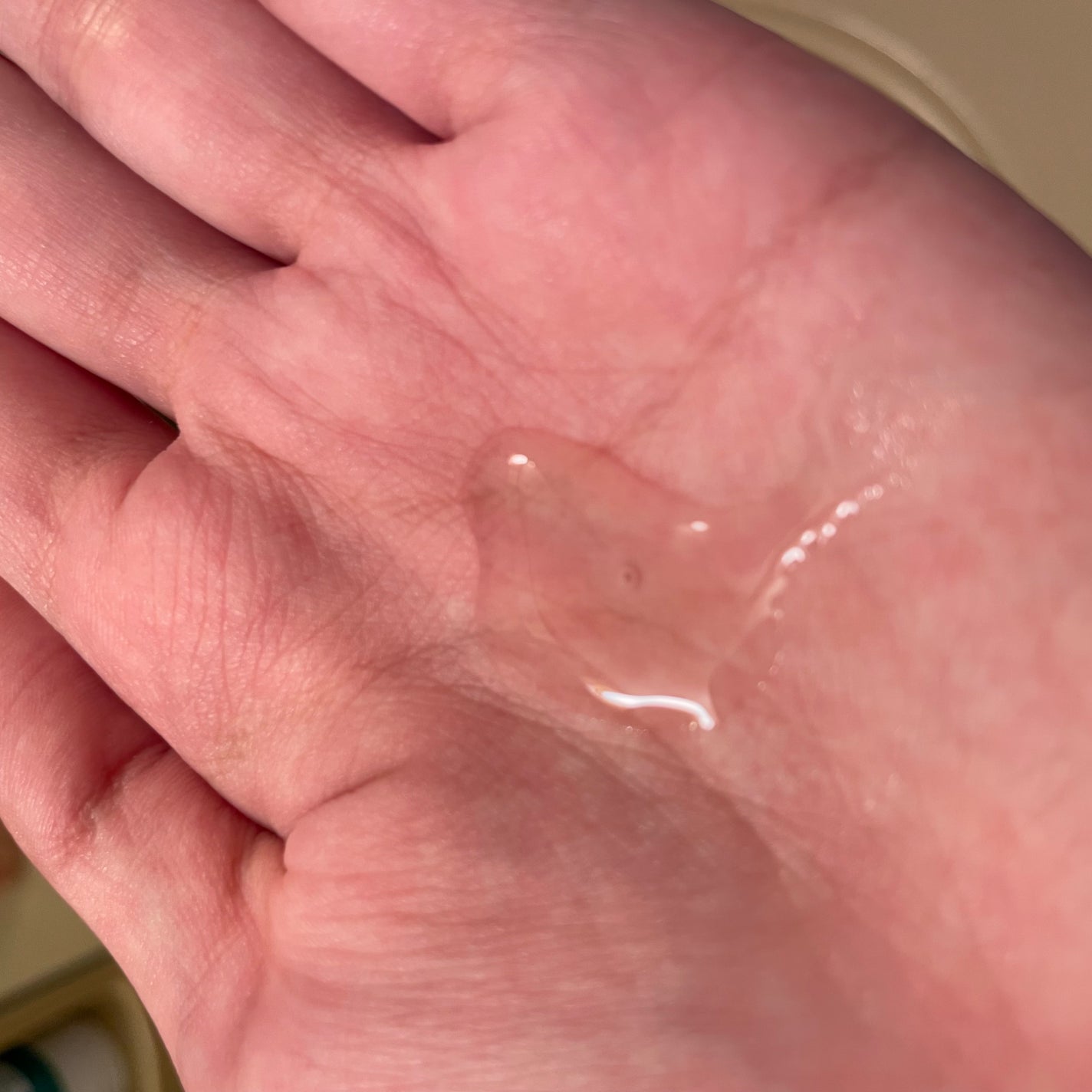 薬用 RJ地肌ケア エッセンス /アピセラピーコスメティクス/頭皮ローションを使ったクチコミ(2枚目)