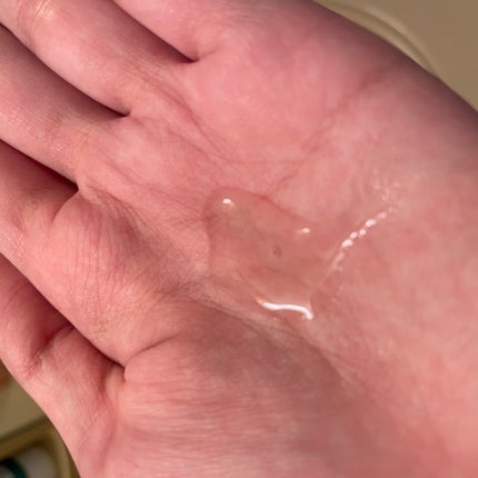 薬用 RJ地肌ケア エッセンス /アピセラピーコスメティクス/頭皮ローションを使ったクチコミ(2枚目)