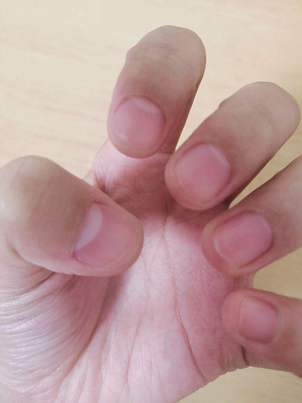 ナイトケア手袋/DAISO/ボディグッズを使ったクチコミ（2枚目）