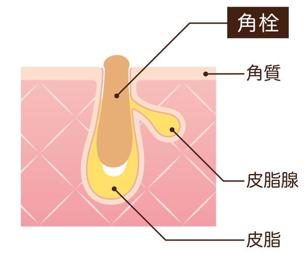 【黒ずみ汚れや角栓】小鼻の毛穴トラブルの原因と正しいケア方法は?おすすめアイテム20選も紹介の画像