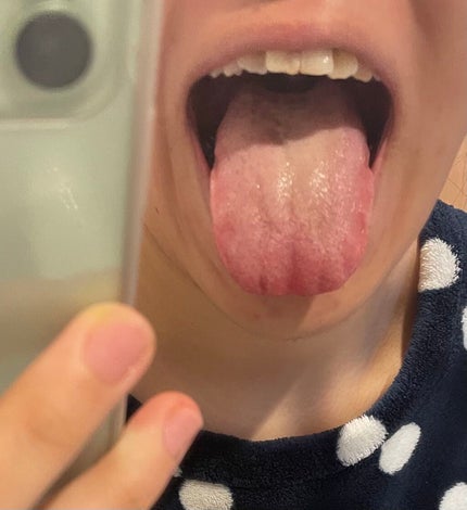 舌クリーナー/NONIO/その他オーラルケアを使ったクチコミ(2枚目)