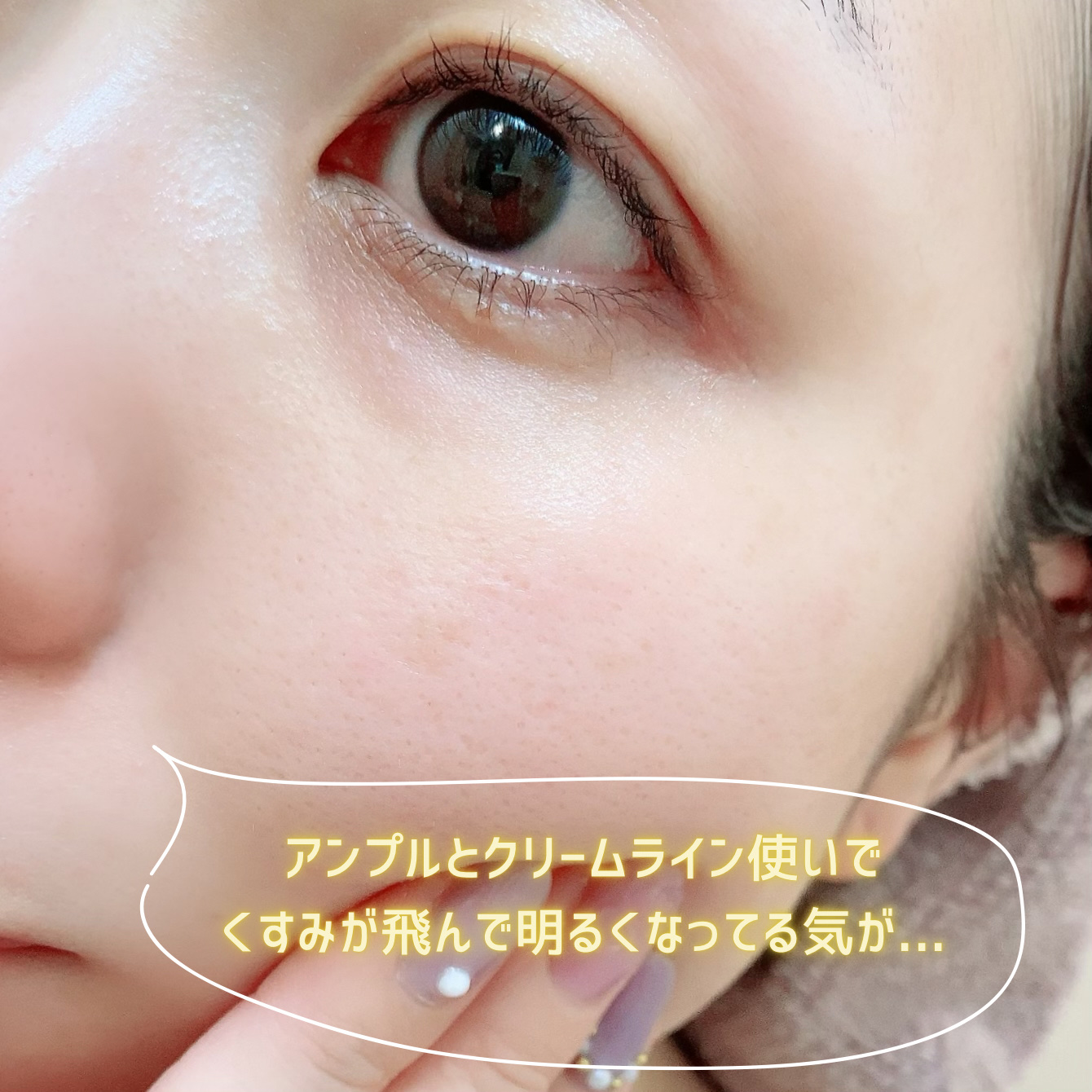 ビタシューティカル7＋ラディアンスクリーム/Dr.G/フェイスクリームを使ったクチコミ（3枚目）