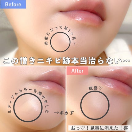 カバーアッププロコンシーラー/TFIT/パレットコンシーラーを使ったクチコミ(3枚目)