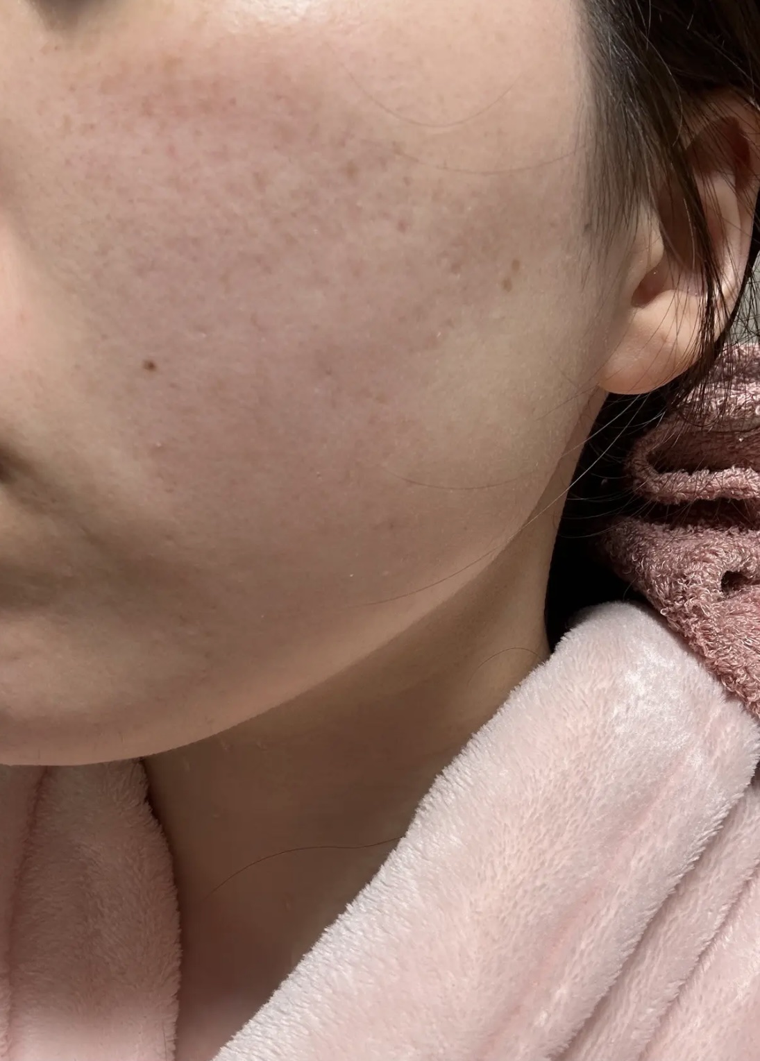 どんぐり ポア ペプチド パッド/SKINFOOD/トナーパッドを使ったクチコミ（3枚目）