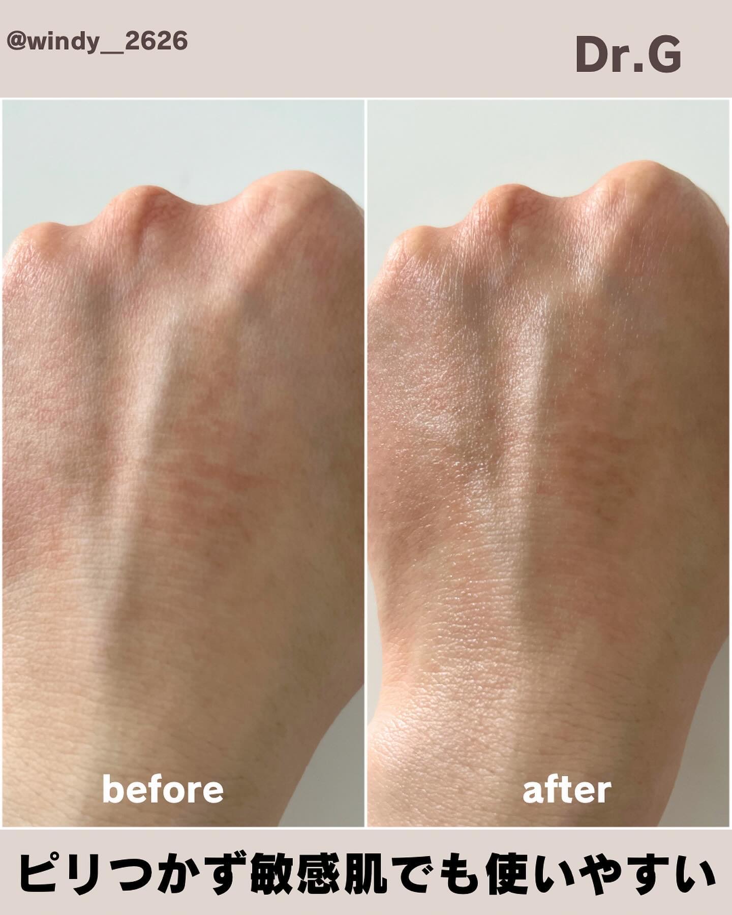 ビタシューティカル7＋ラディアンスクリーム/Dr.G/フェイスクリームを使ったクチコミ（3枚目）