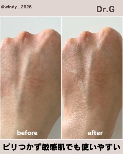 Dr.G ビタシューティカル7+ラディアンスクリームのクチコミ「⌇Dr.G
▶︎ ビタシューティカル15プラスアンプル
\ ポイント☝️/
⚪︎ 安定性を.....」(3枚目)
