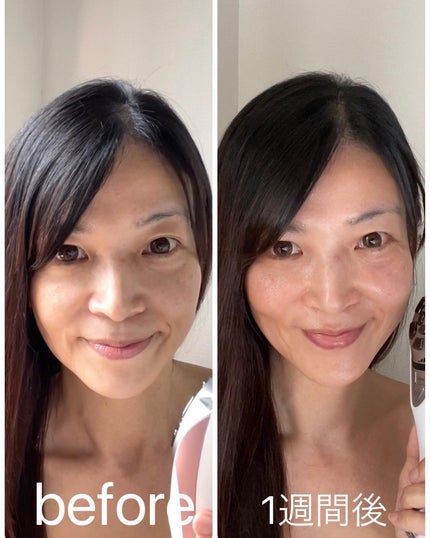 VISAGE|LUXCEARの効果に関する口コミ - ルクセアヴィサージュS VISAGE|LUXCEARの効果に関する口コミ - ルクセアヴィサージュS