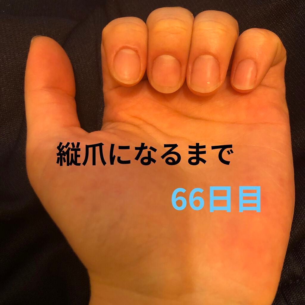 ð on LIPS ã瞊çªã«ãªãããã«ãããããªæ¹æ³ããã£ããæããŠãã ããð瞊çªã«..ãïŒ1æç®ïŒ