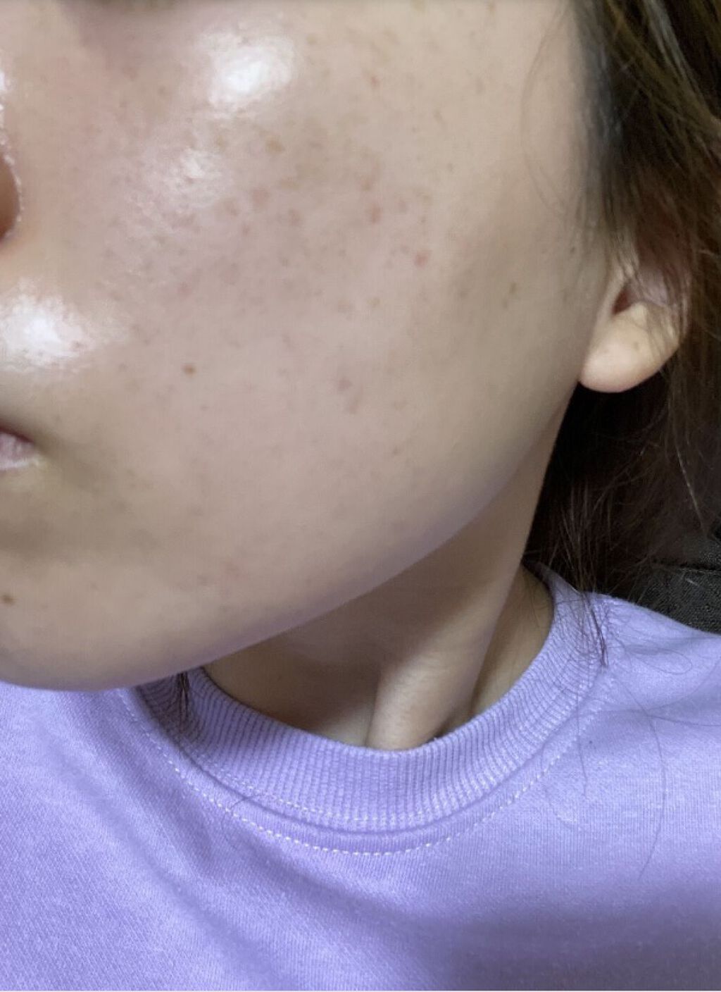 モイスチャー リッチローション(とてもしっとり)/アルージェ/化粧水を使ったクチコミ（3枚目）