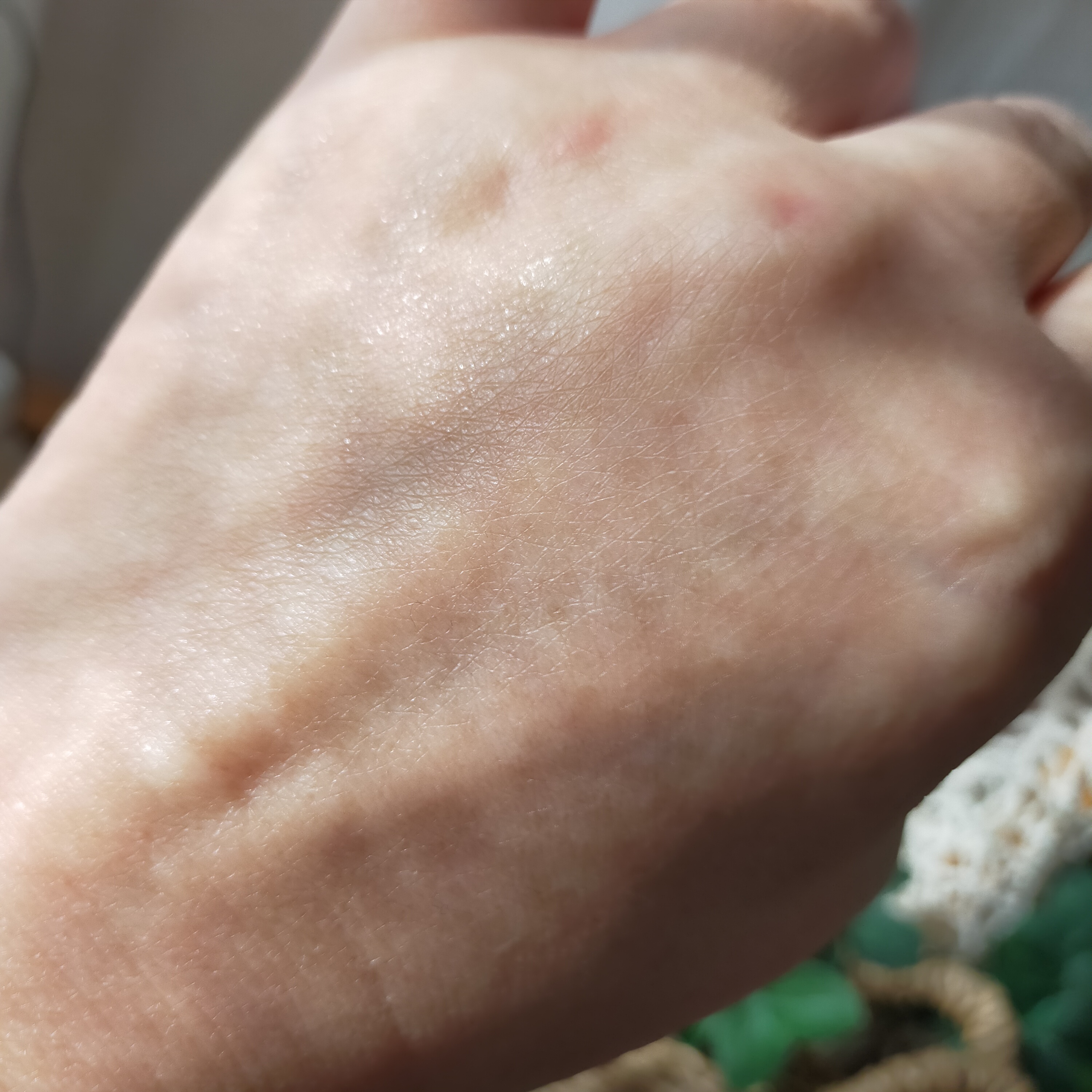 ビセットクリア/BISET/美容液を使ったクチコミ（3枚目）