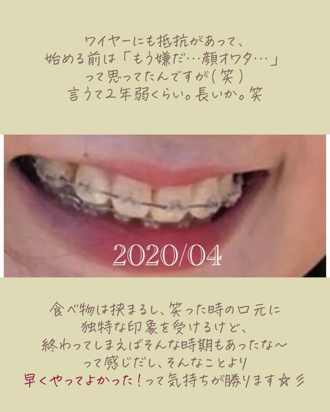 アパガードプレミオ/アパガード/歯磨き粉を使ったクチコミ(3枚目)