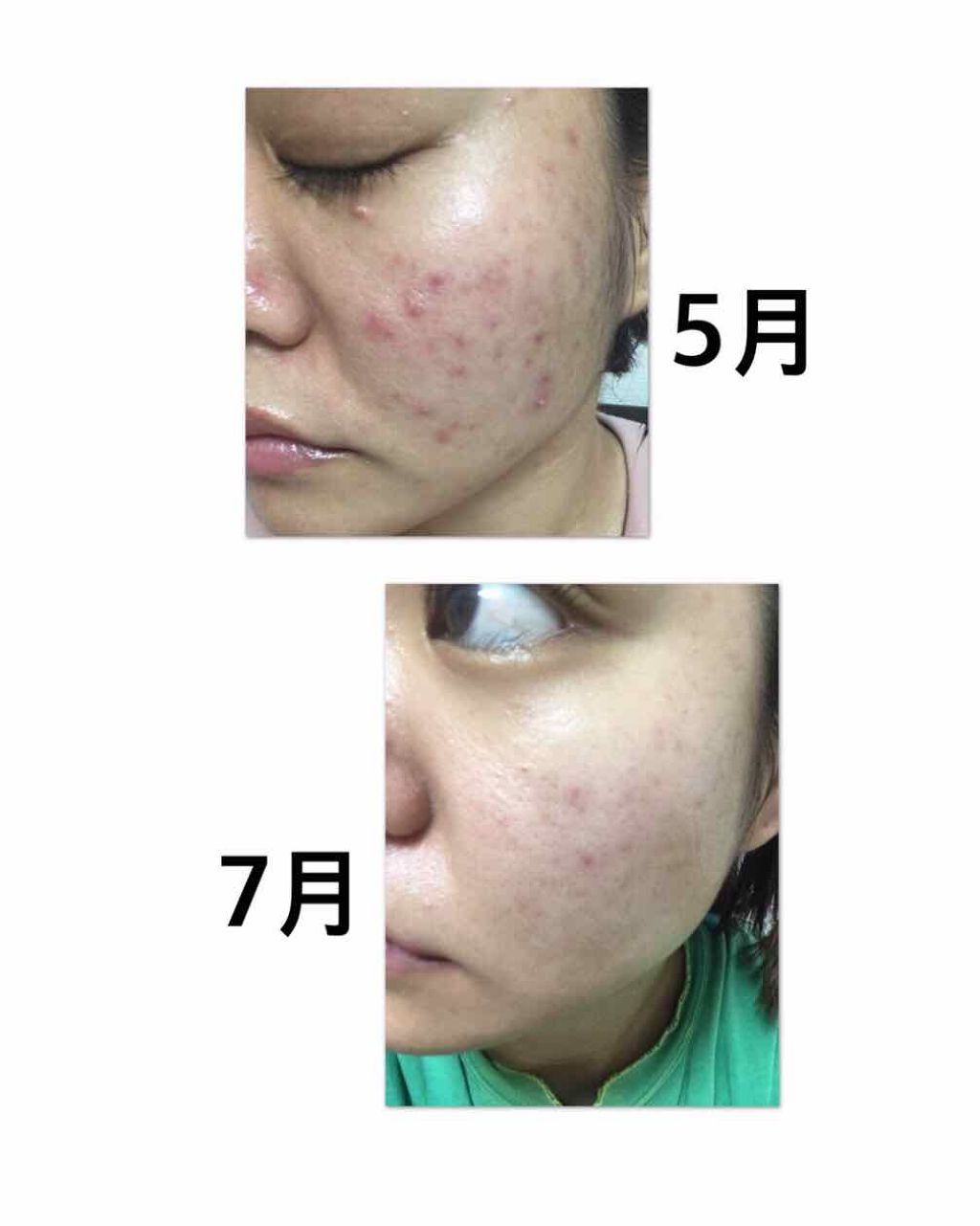 敏感肌用薬用美白美容液/無印良品/美容液を使ったクチコミ(2枚目)