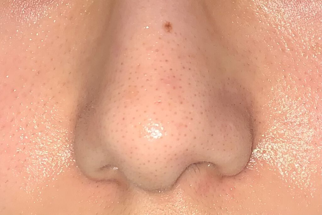 デュオ ザ クレンジングバーム クリア/DUO/クレンジングバームを使ったクチコミ（2枚目）