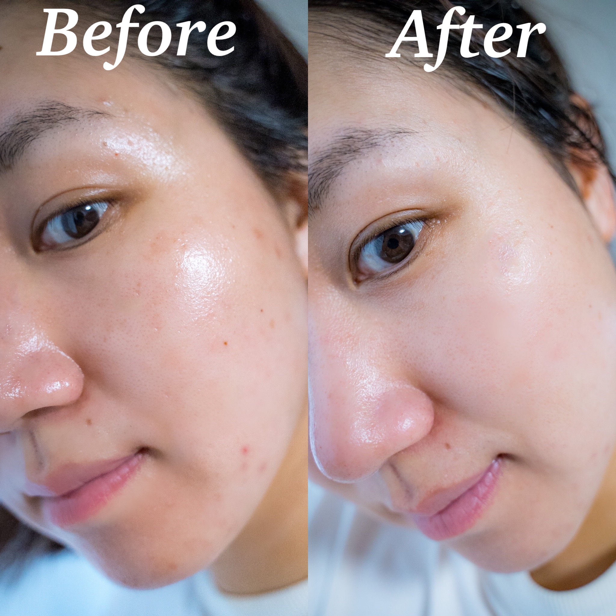 シカレチA セブンデイズマスク/VT/シートマスク・パックを使ったクチコミ（2枚目）