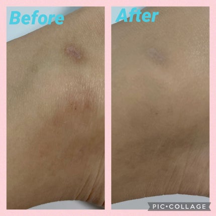 カバーステイWPファンデーションUV/コフレドール/パウダーファンデーションを使ったクチコミ(7枚目)