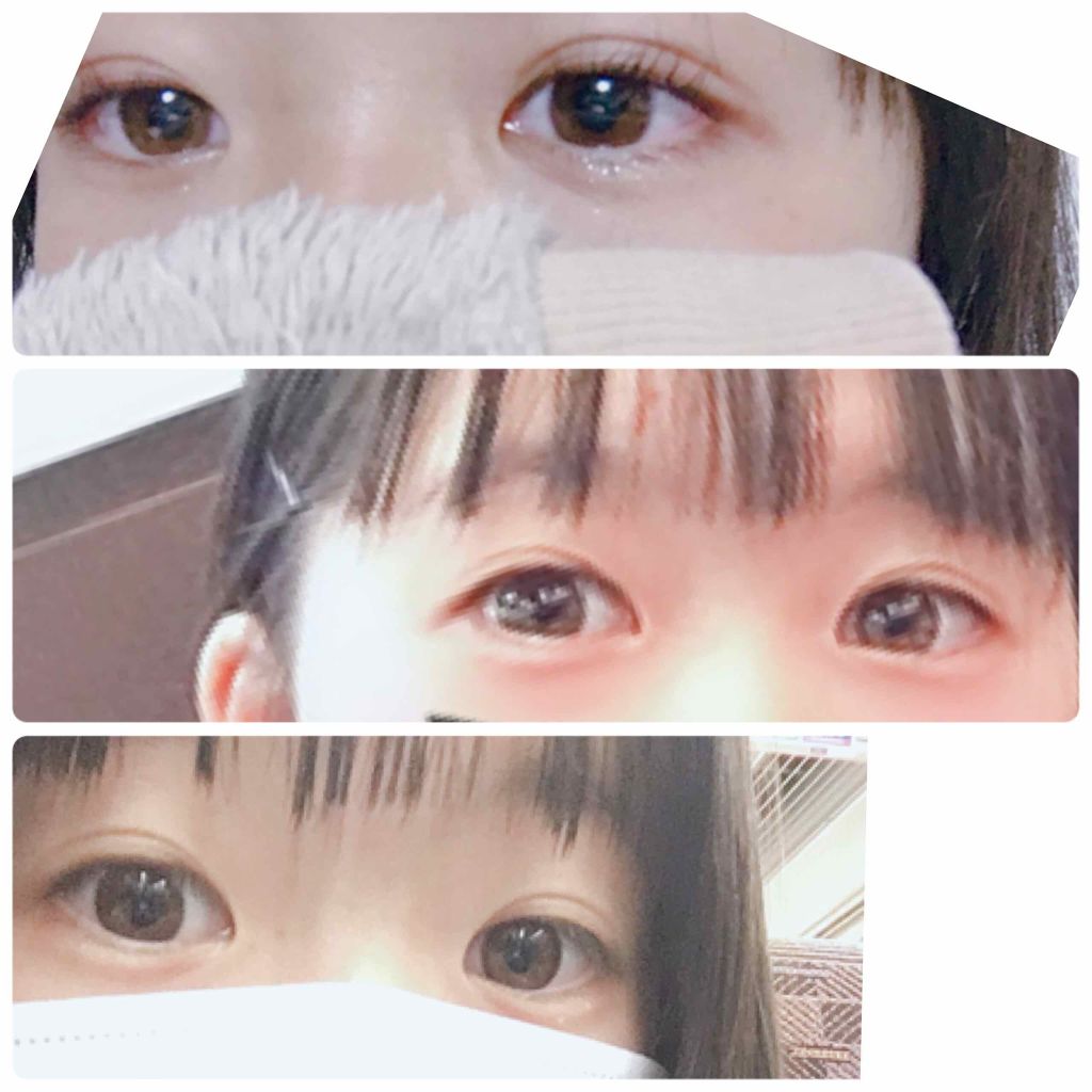 アイビューティー フィクサー WP/アストレア ヴィルゴ/二重まぶた用アイテムを使ったクチコミ（3枚目）
