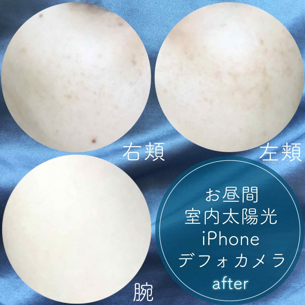 ホワイトCクリア(医薬品)/トランシーノ/その他を使ったクチコミ(3枚目)