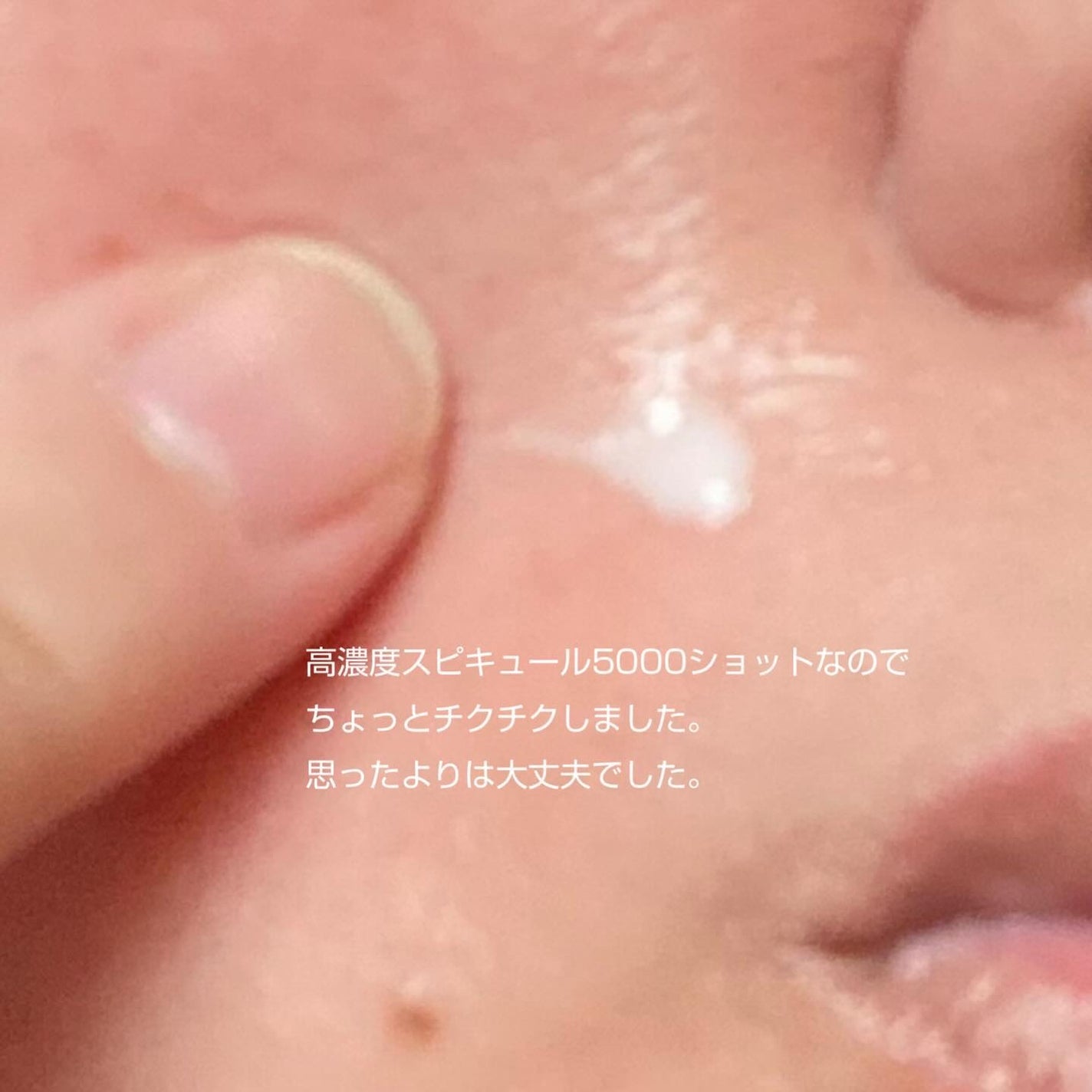 ダイヤスピキュール/NUDIQUE/美容液を使ったクチコミ(7枚目)