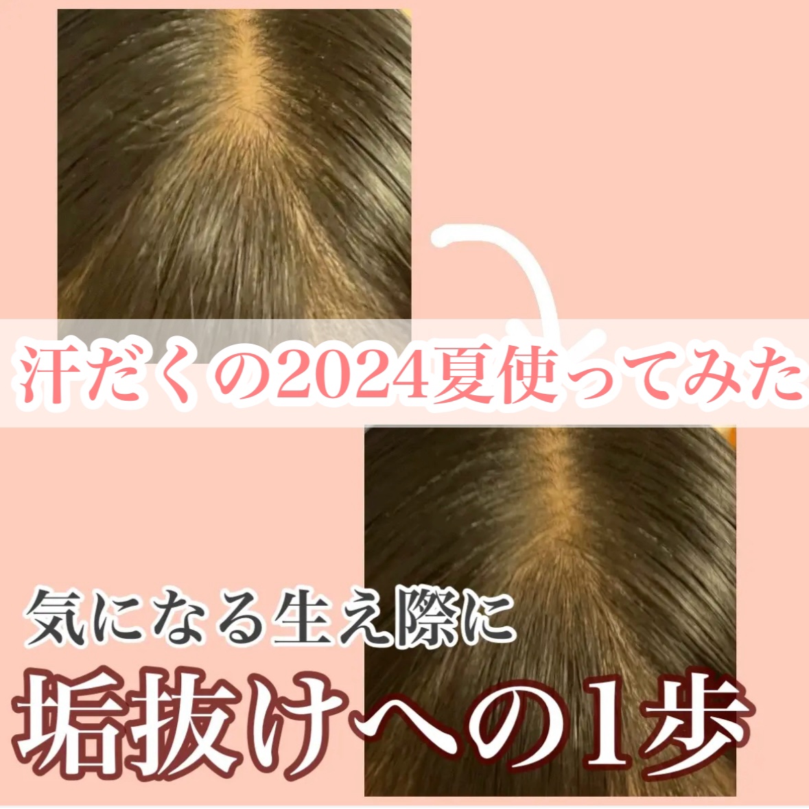 【革命級の2024セザンヌ新作ハゲ隠し！夏でも使えるの？】


1月に紹介した、セザンヌヘアメイクパウダー！
当時はめちゃくちゃいいとレビューしたのですが、夏は正直どうなるんだろうと思っていました

そこで今年の夏使ってみたのでレビューしま