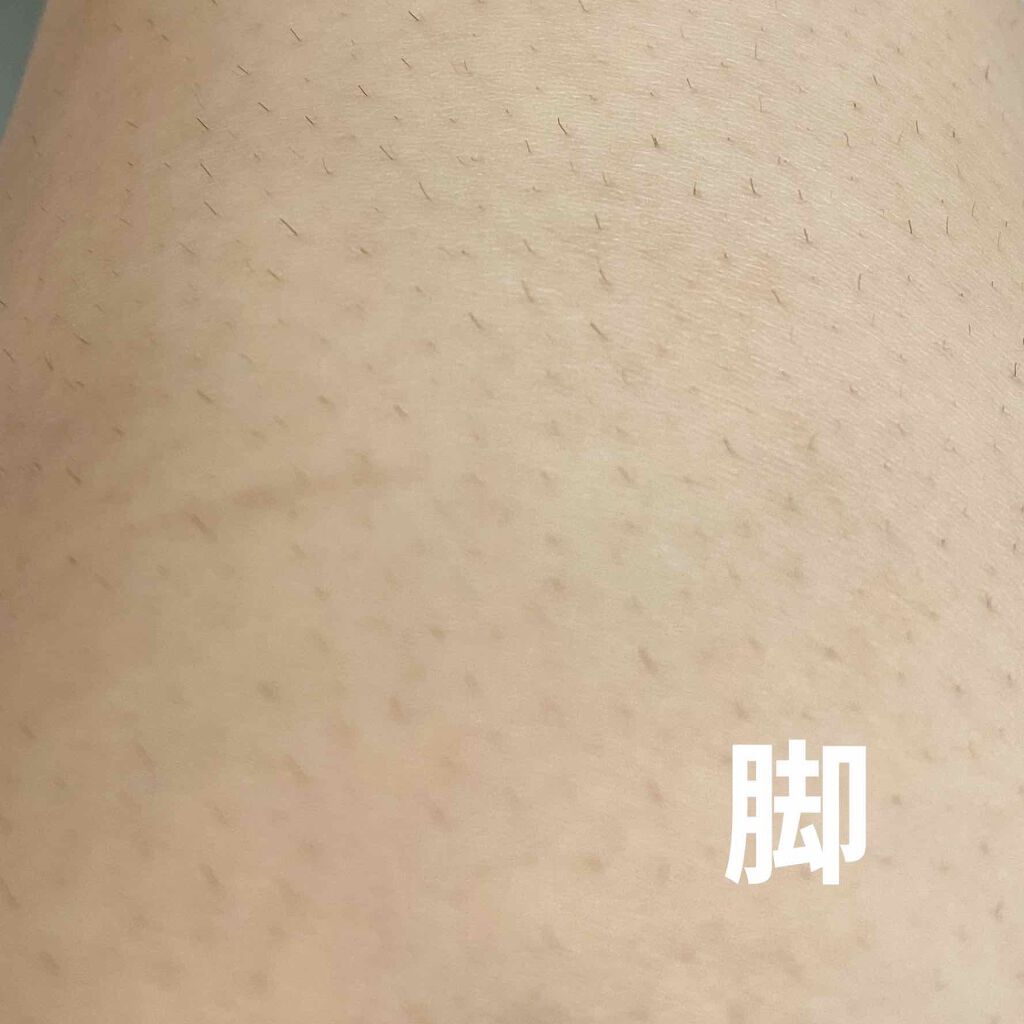 ブラウンシルクエキスパート (光美容器)/ブラウン/家庭用脱毛器を使ったクチコミ(2枚目)