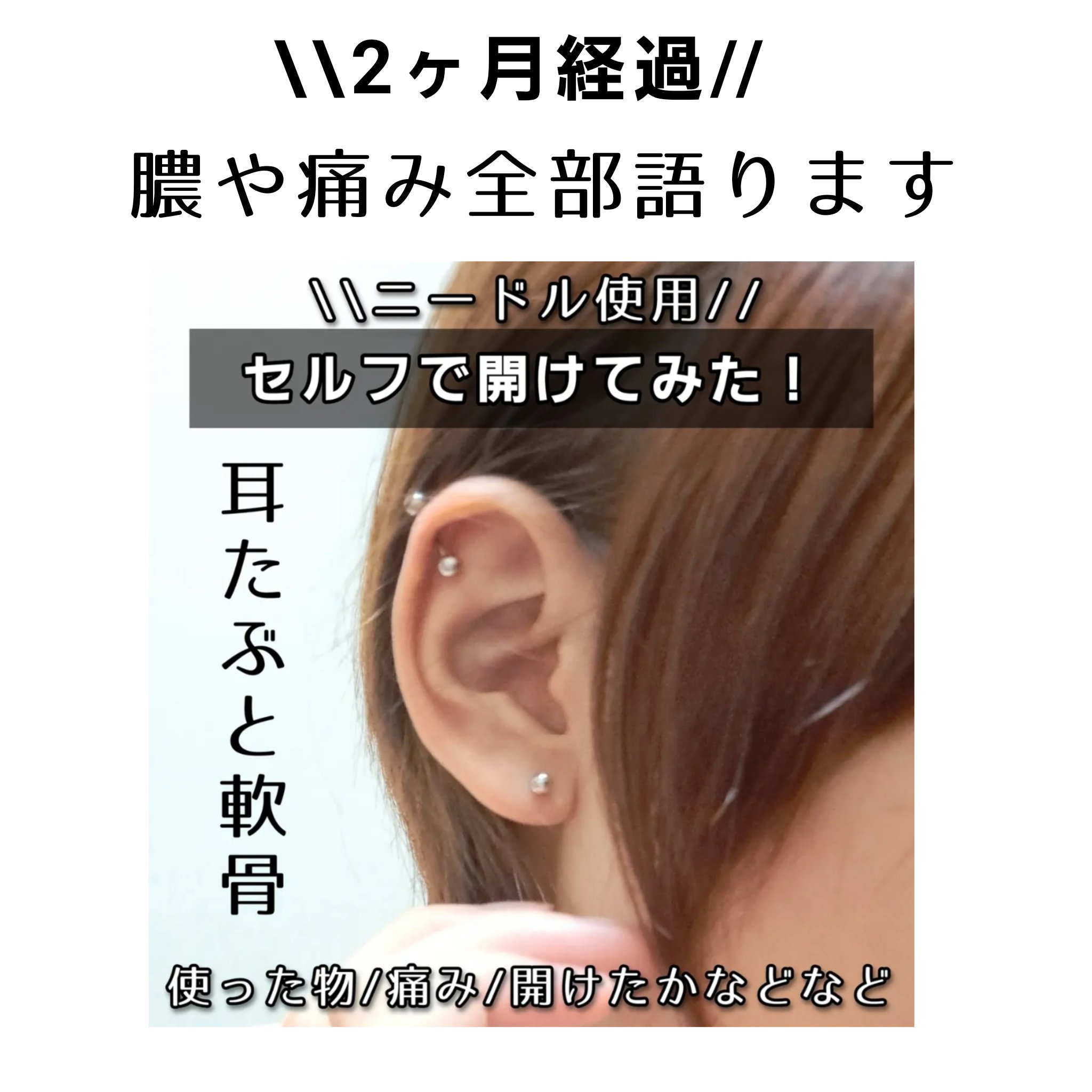 🤯ニードルでセルフで開けたピアスホールの経過
最初の頃は透明な汁が出まくってた。
耳たぶ痛みは特になし。軟骨は1週間くらいちょっと痛かった。引っ掛けるとどこも痛い。
2週間くらいでちょっと腫れてきてピアスを外してグリグリしたら濁った血がで