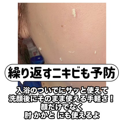 薬用クリアジェル/ルシフェル/ピーリングを使ったクチコミ(3枚目)