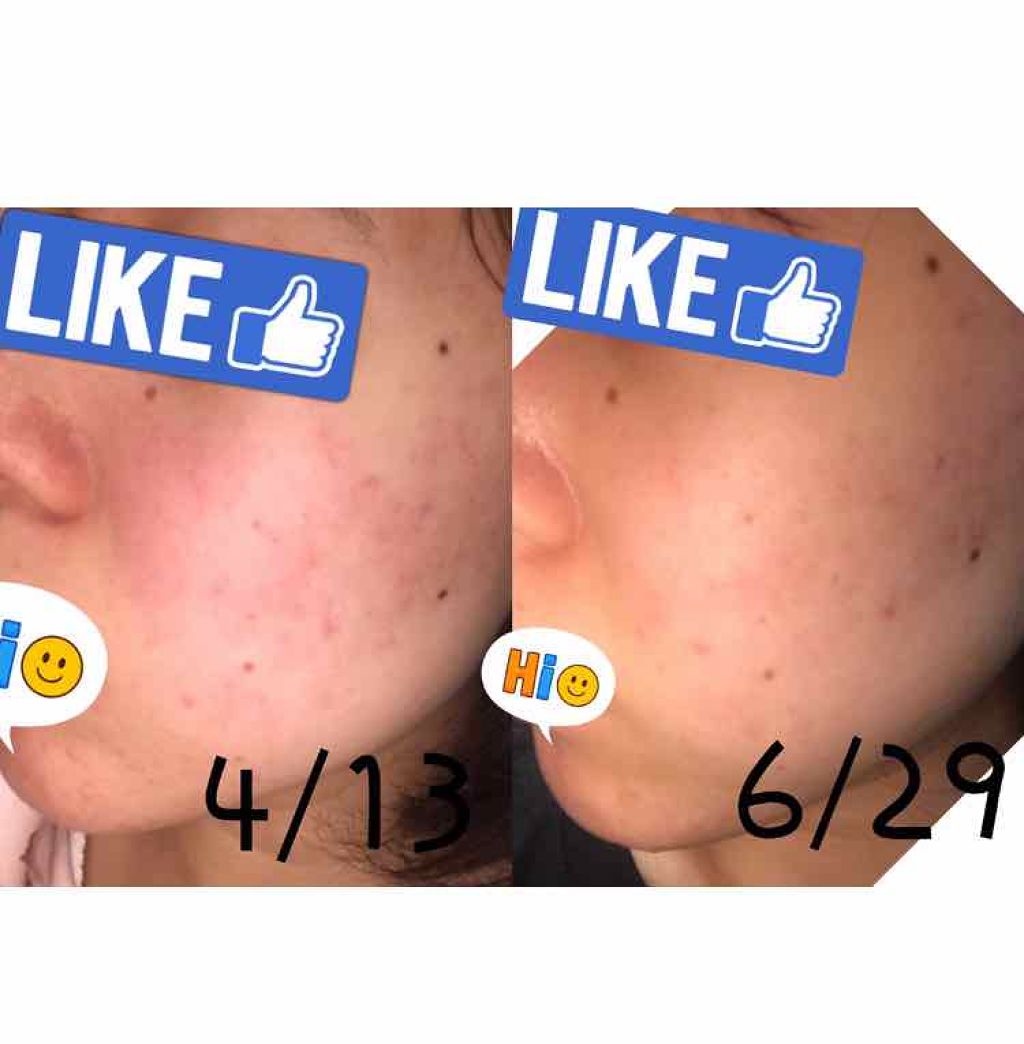 敏感肌用薬用美白美容液/無印良品/美容液を使ったクチコミ（1枚目）