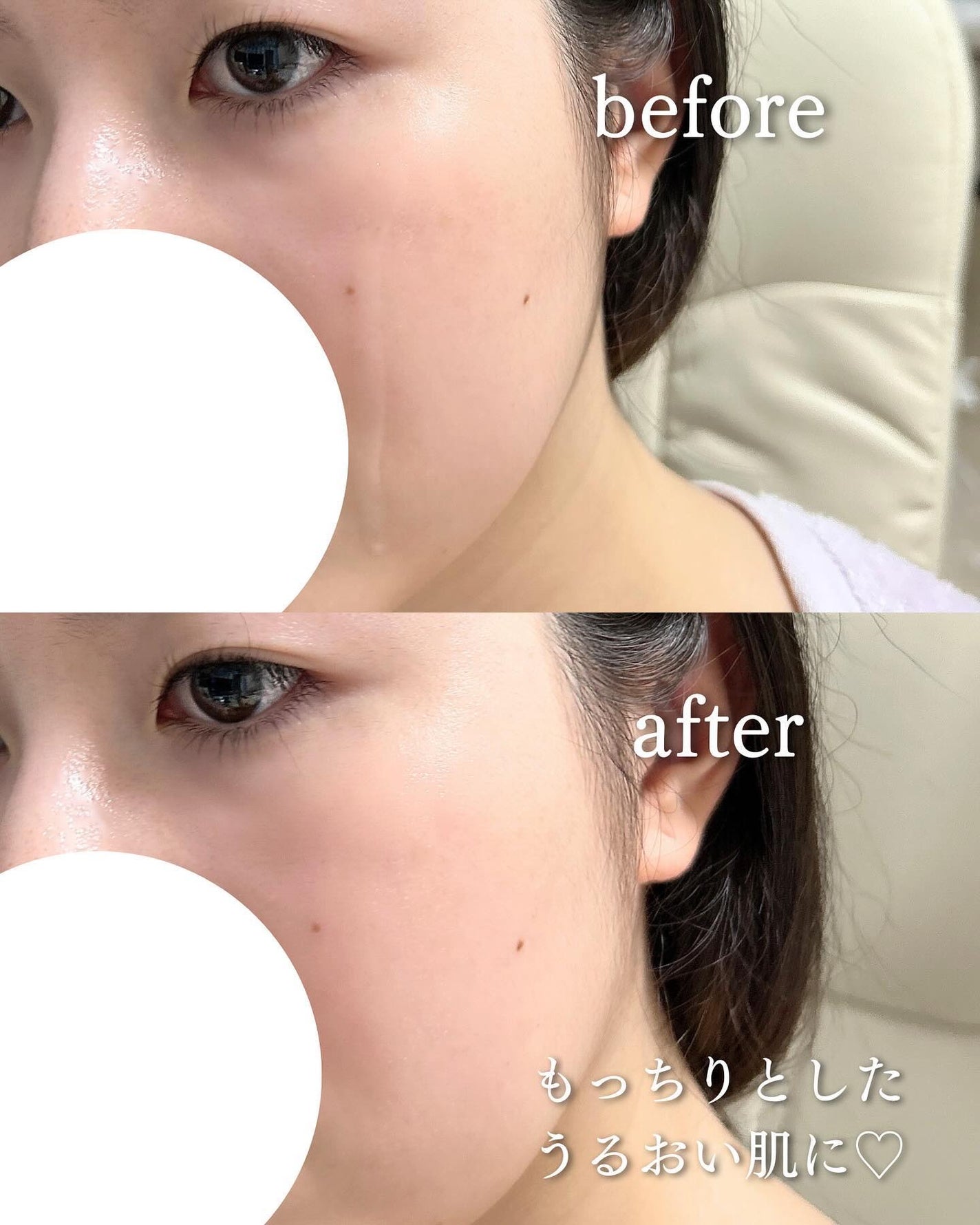 ザモイスチャーバリアDリキッドトナー/Dr.G/化粧水を使ったクチコミ(4枚目)