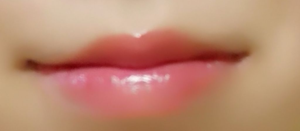 モアリップ N (医薬品)/資生堂薬品/その他を使ったクチコミ（2枚目）