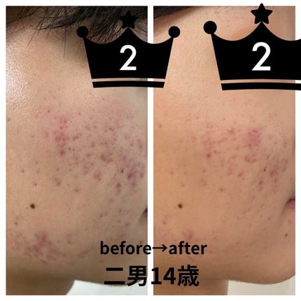 明色美顔水 薬用化粧水/美顔/化粧水を使ったクチコミ(3枚目)