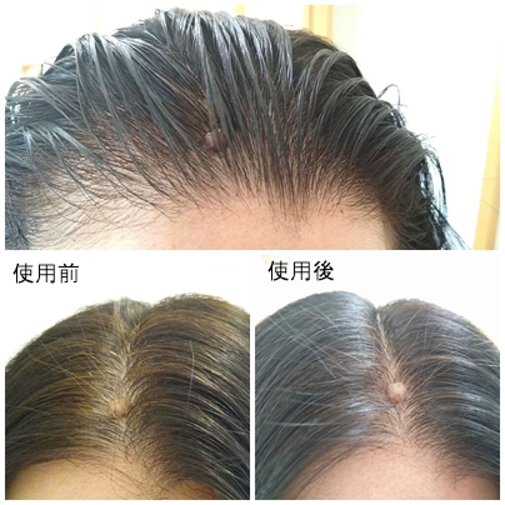 カラートリートメント/サイオス/ヘアカラーを使ったクチコミ（3枚目）