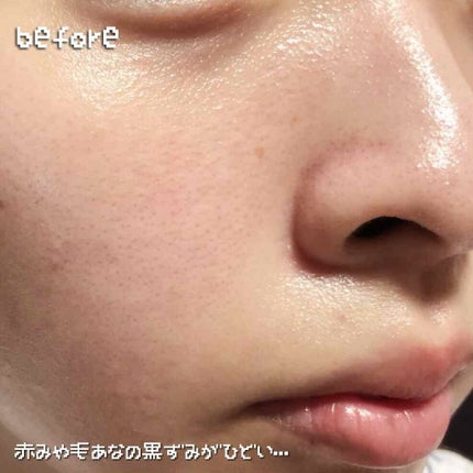 ジョンセンムル エッセンシャル スキン ヌーダー クッション/JUNG SAEM MOOL/クッションファンデーションを使ったクチコミ(2枚目)