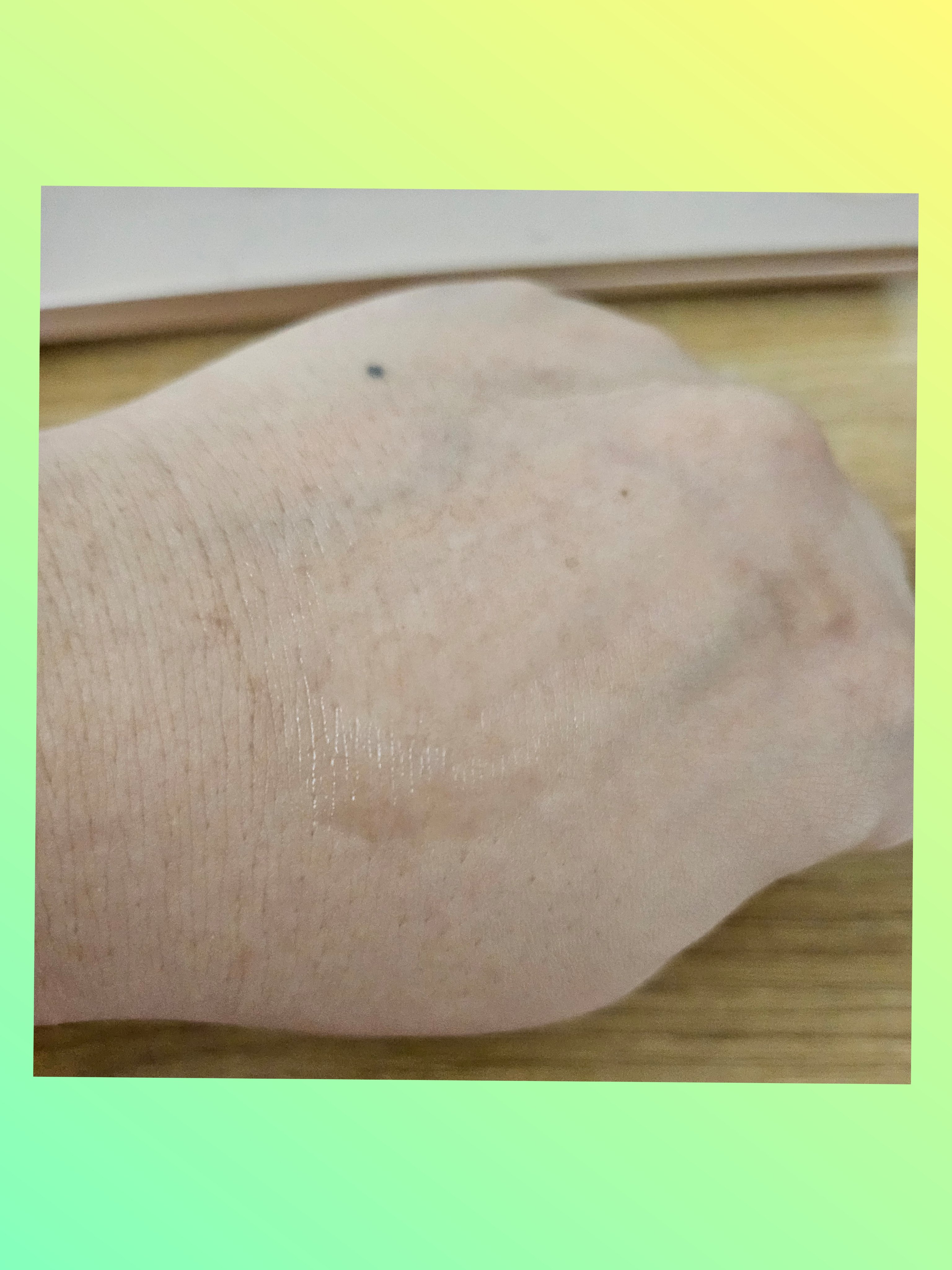 フィトカーミング マイクロバイオームアンプル/マデカダーマ/美容液を使ったクチコミ（3枚目）