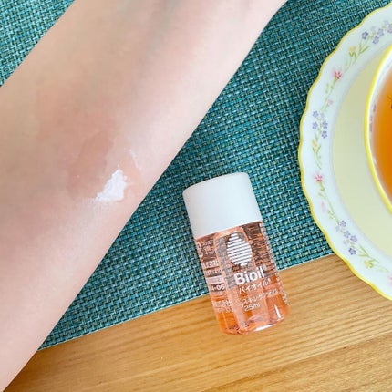 バイオイル/バイオイル/フェイスオイルを使ったクチコミ(8枚目)