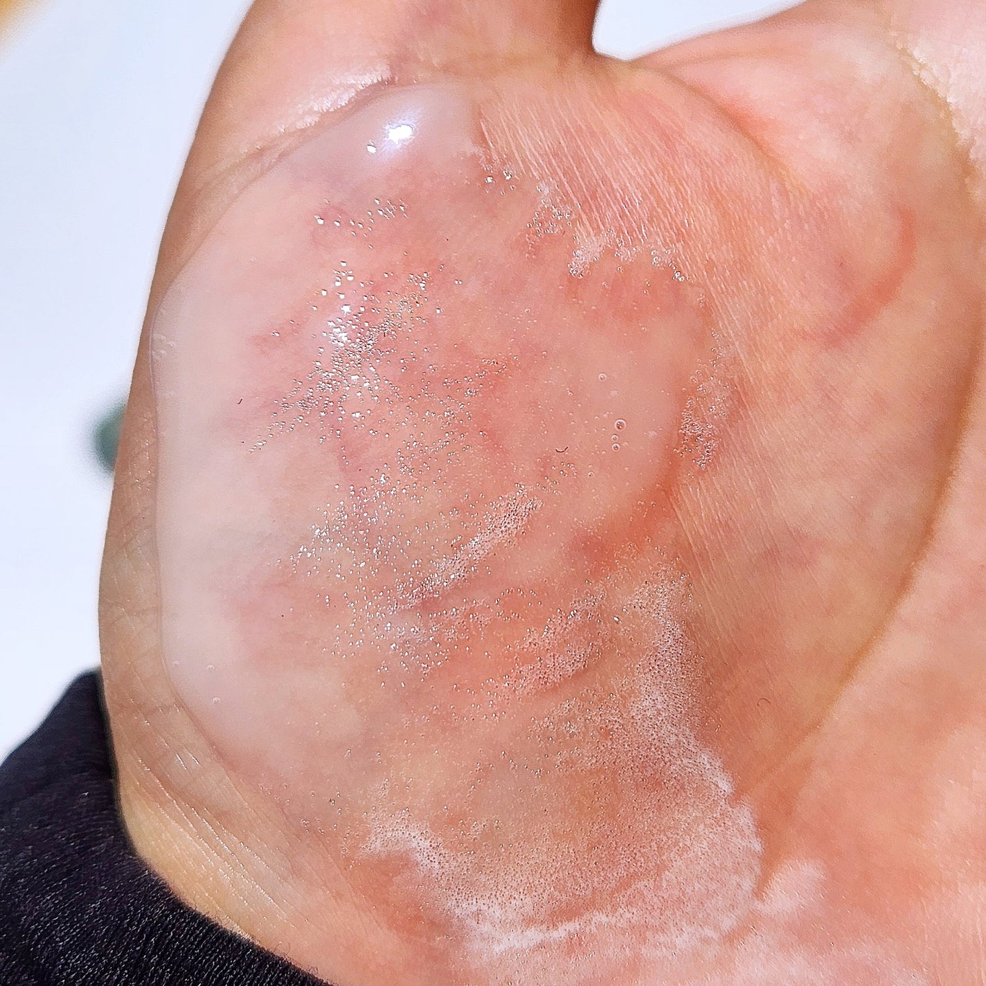 スパークリングスカルプスケーラー/ミンツリー/頭皮ケアを使ったクチコミ(3枚目)