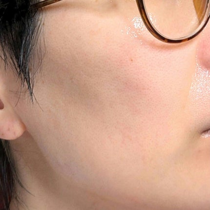 S100 ビタライトリードル/VT/美容液を使ったクチコミ(4枚目)