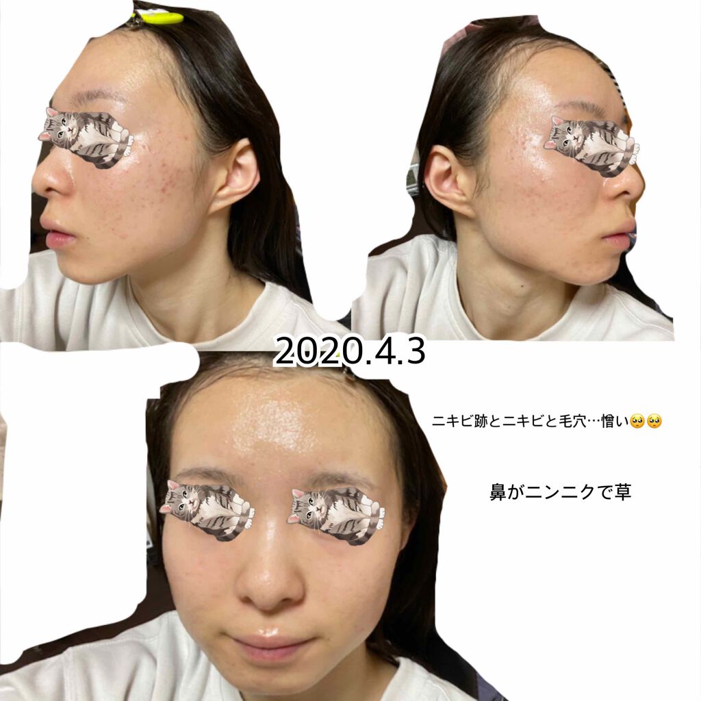 白色ワセリン 医薬品 健栄製薬の口コミ 2枚目閲覧注意 Iphone11にしたので By 抹茶 敏感肌 10代後半 Lips