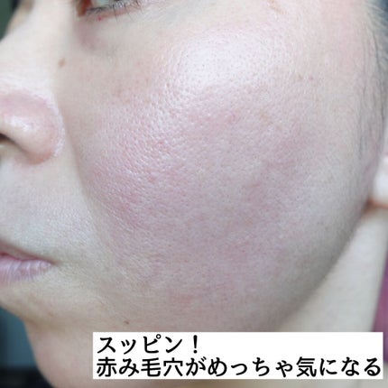 マイクロコレクトフィットクッション/moonshot/クッションファンデーションを使ったクチコミ(5枚目)